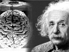 Khác thường trong bộ não Albert Einstein